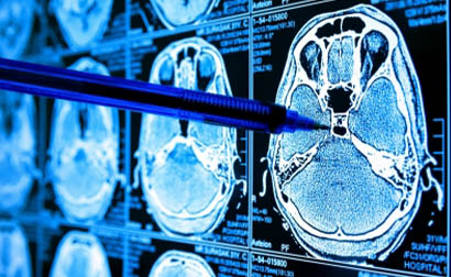 Imagerie des mastodynies dans le service de radiodiagnostic et imagerie médicale du CHU de treichville