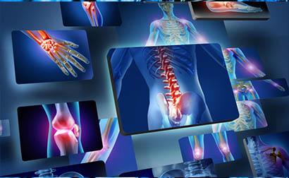 Apport de l’angioscanner dans le diagnostic des pathologies des troncs supra aortiques : A propos de 96 cas colligés à Abidjan